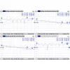 Kabelis Mmcx į RPSMA/ACMMCXRPSMA Mikrotik