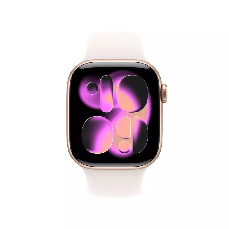 Apple Watch Series 11 GPS 42mm rožinio aukso aliuminio korpusas, šviesiai rožinis sportinis dirželis S/M