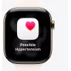 Apple Watch SE 3 GPS + Cellular 40 mm vidurnakčio aliuminio korpusas su juodu dirželiu