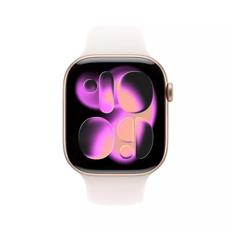 Išmanusis laikrodis Apple Watch Series 11 GPS + Cellular 46mm rožinio aukso aliuminis su Light Blush sportine juostele M/L