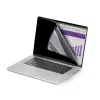 StarTech.com privatumo ekrano apsauga, skirta 16 colių MacBook Pro 21/23, nuimamas ir reversinis, antirefleksinis, magnetinis, su 51 % mėlynos šviesos mažinimu