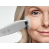 HoMedics MD-1000-EU2 odos priežiūros prietaisas – vakuuminė mikrodermabrazija, balta