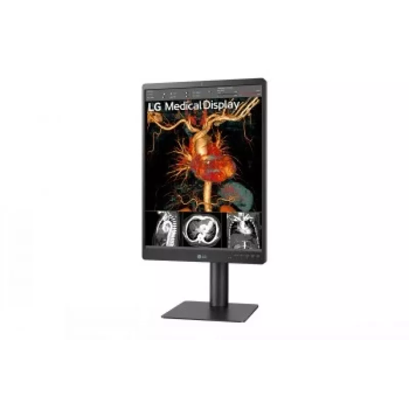 LG 21.3 inch 3MP IPS diagnostinis monitorius 21HQ513D-M